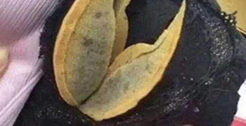 內(nèi)衣發(fā)霉怎么辦？霉博來士教你除霉措施！